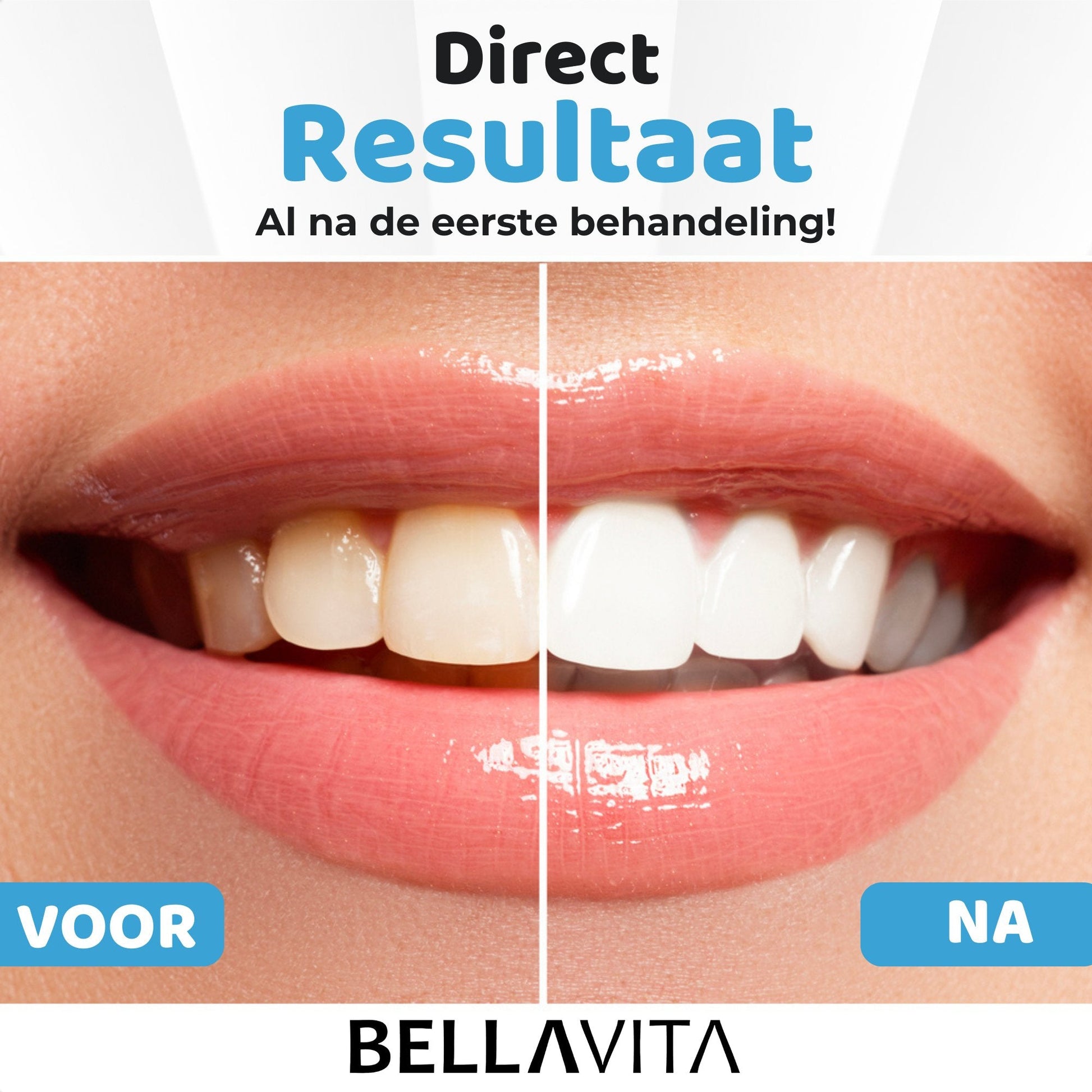 BELLAVITA ® Tandenbleekset - Bellavita